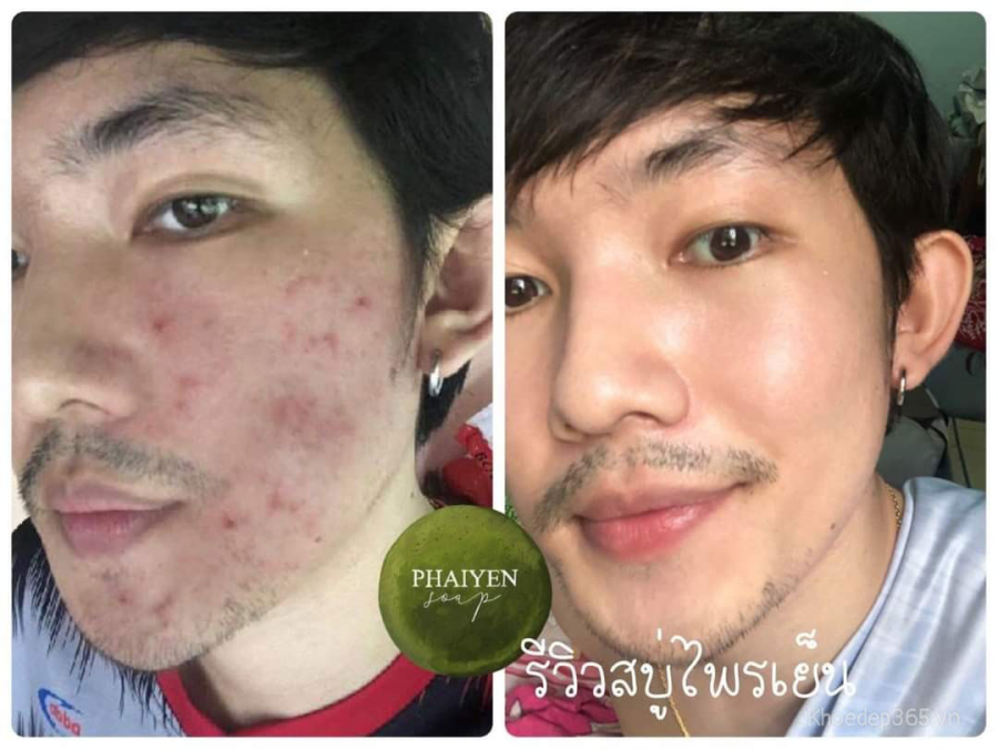 Xà Phòng Rửa Mặt Trị Mụn Thảo Dược Phaiyen Soap Thái Lan Sửa Rửa Mặt-1