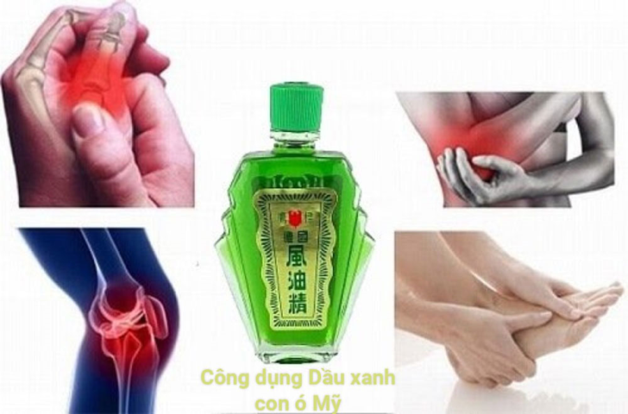 Dầu Gió Xanh Con Ó Mỹ Eagle Brand Medicated Oil 24ml Dầu Thảo Dược-1