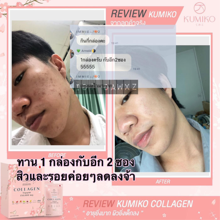 Collagen Kumiko Tripeptide 150.000 Dưỡng trắng da Thái Lan Kem Dưỡng Trắng Da-1