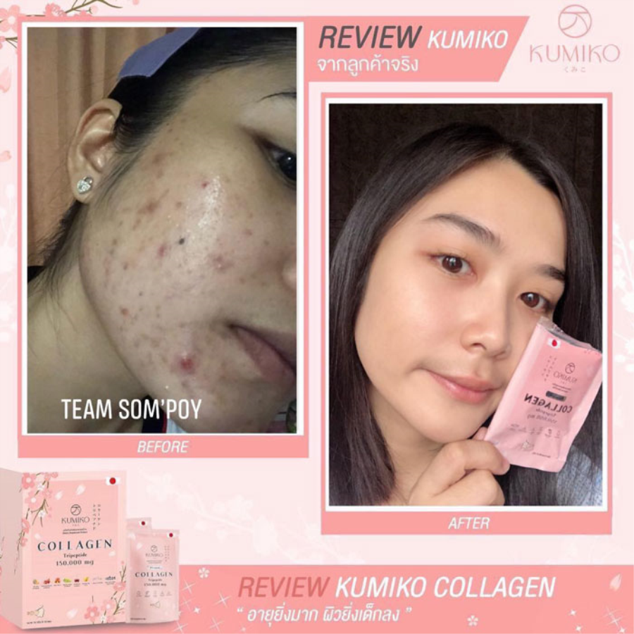 Collagen Kumiko Tripeptide 150.000 Dưỡng trắng da Thái Lan Kem Dưỡng Trắng Da-2