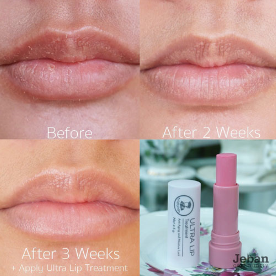 Son Dưỡng ẩm, ngừa thâm, chống lão hóa Ultra Lip Treatment Trang điểm môi-1