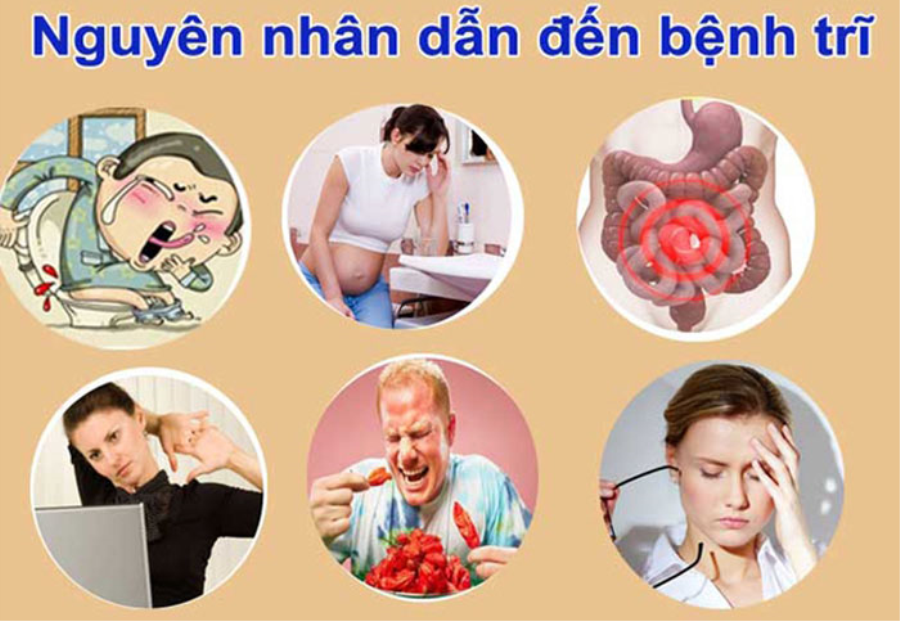 Kem Bôi Trĩ Doproct Thái Lan Sản phẩm khác-1