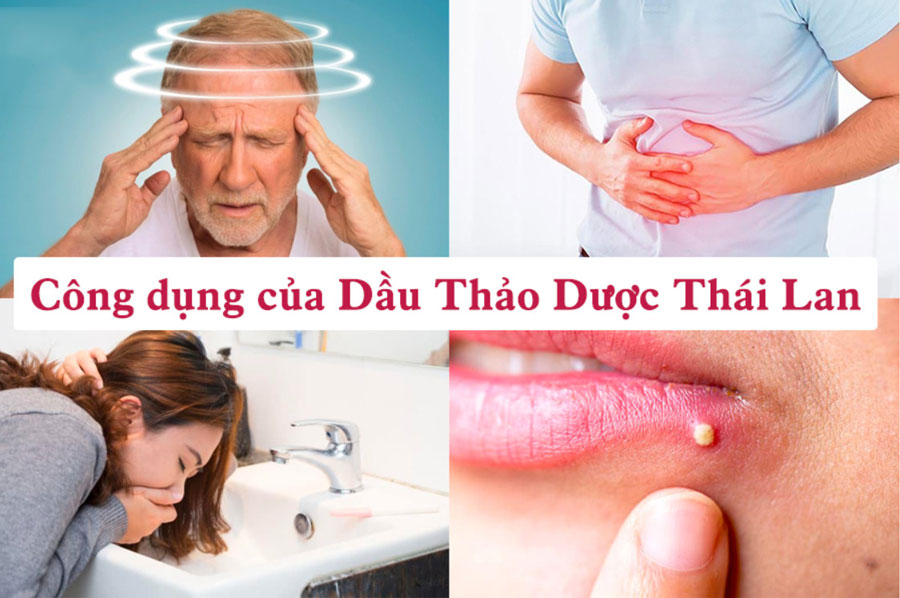 Dầu Lăn Sâm Thảo Dược OTop 19 vị Thái Lan Dầu Thảo Dược-1
