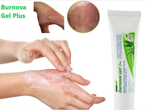 Gel Trị Bỏng Tái Tạo Da Sau Tổn Thương Burnova Gel Plus Thái Lan Dầu Thảo Dược-1