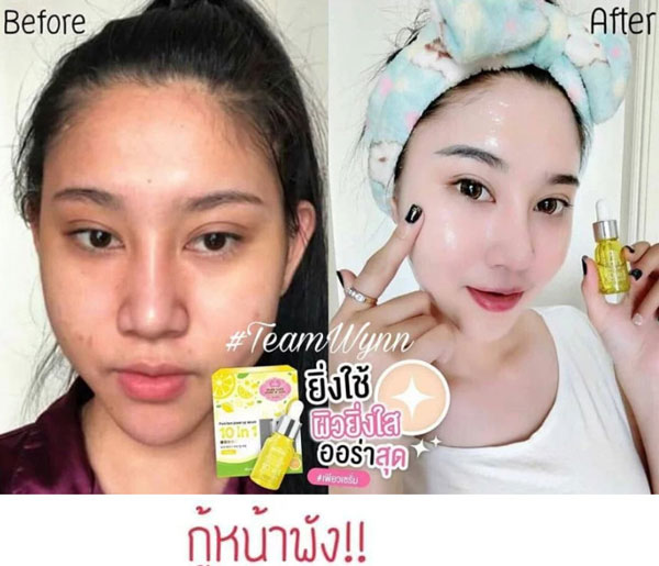 Serum Trị Mụn, Tàn Nhang Pure Face Power Up Jellys 10in1 Serum Dưỡng Trắng Da-1