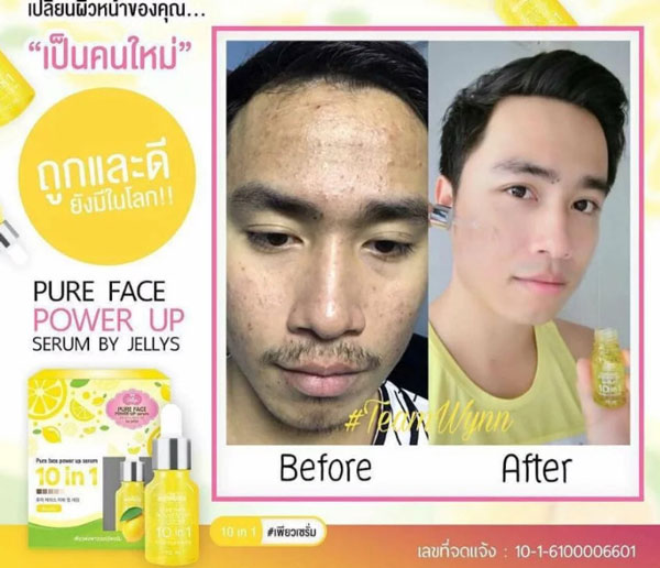 Serum Trị Mụn, Tàn Nhang Pure Face Power Up Jellys 10in1 Serum Dưỡng Trắng Da-1