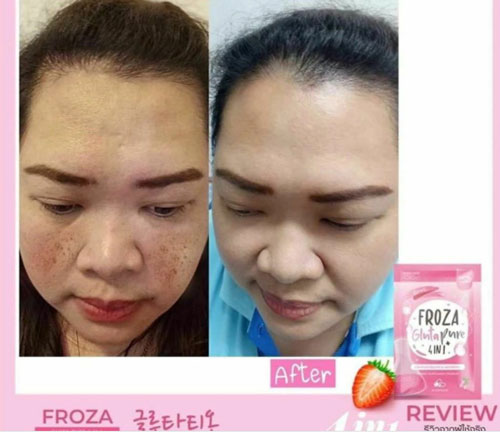 Viên uống trắng da Froza Gluta Pure 4 in 1 Thái Lan Kem Dưỡng Toàn Thân-1